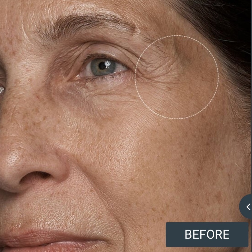 Fresh Black Tea Advanced Age Renewal Eye Cream - Picture 8 of 13
